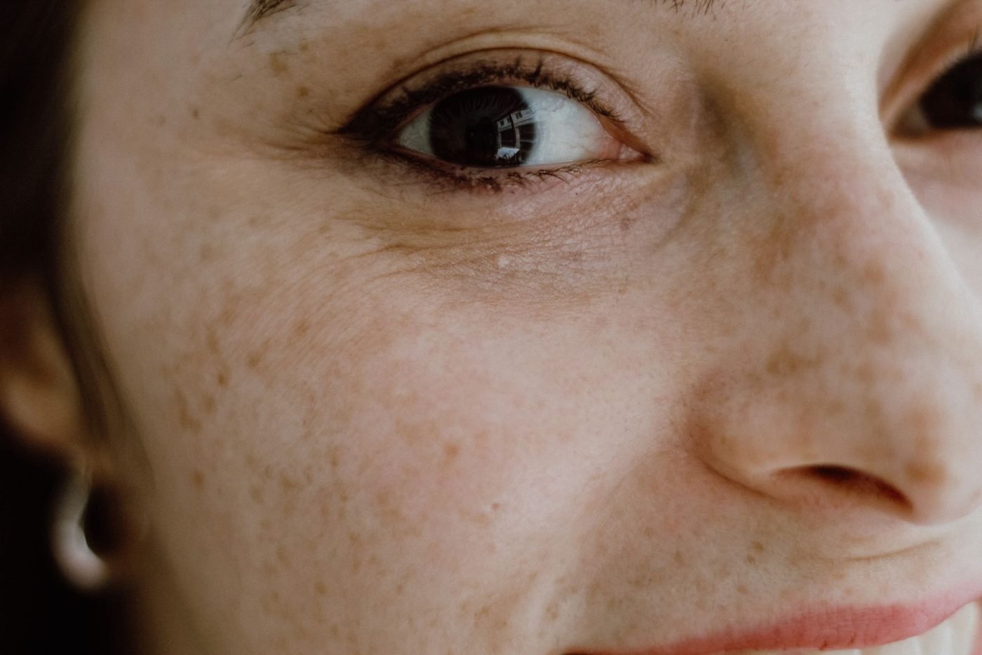 Nahaufnahme von Auge und Unterlid einer Frau mit Sommersprossen